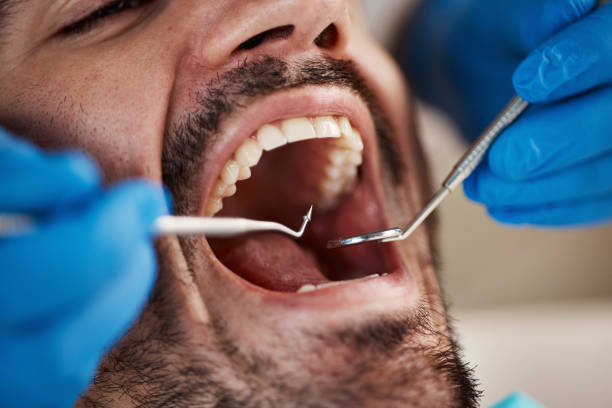 Best Emergency Dentist for Knocked-Out Tooth in Chleston, AR